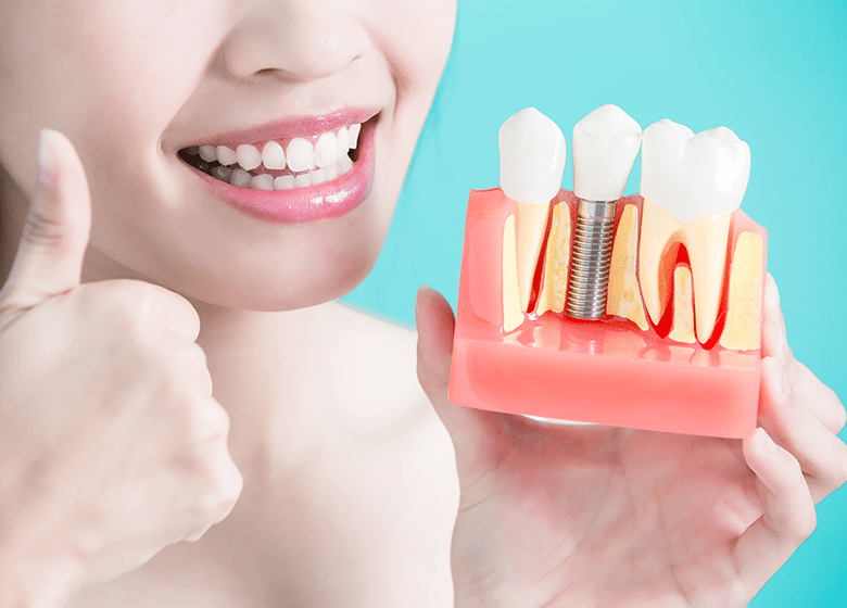 İmplant ve Diş Tedavisi