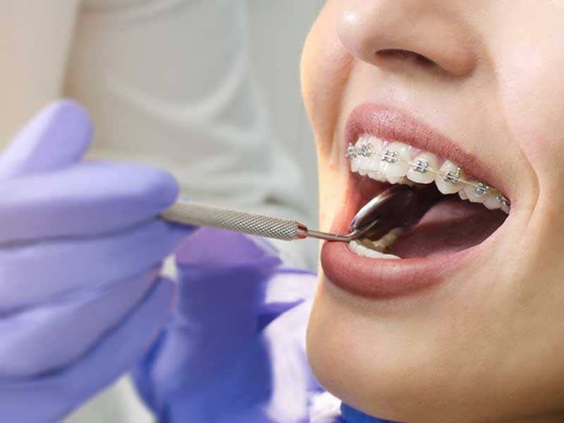 Eryaman Diş İle Sağlıklı Dişler